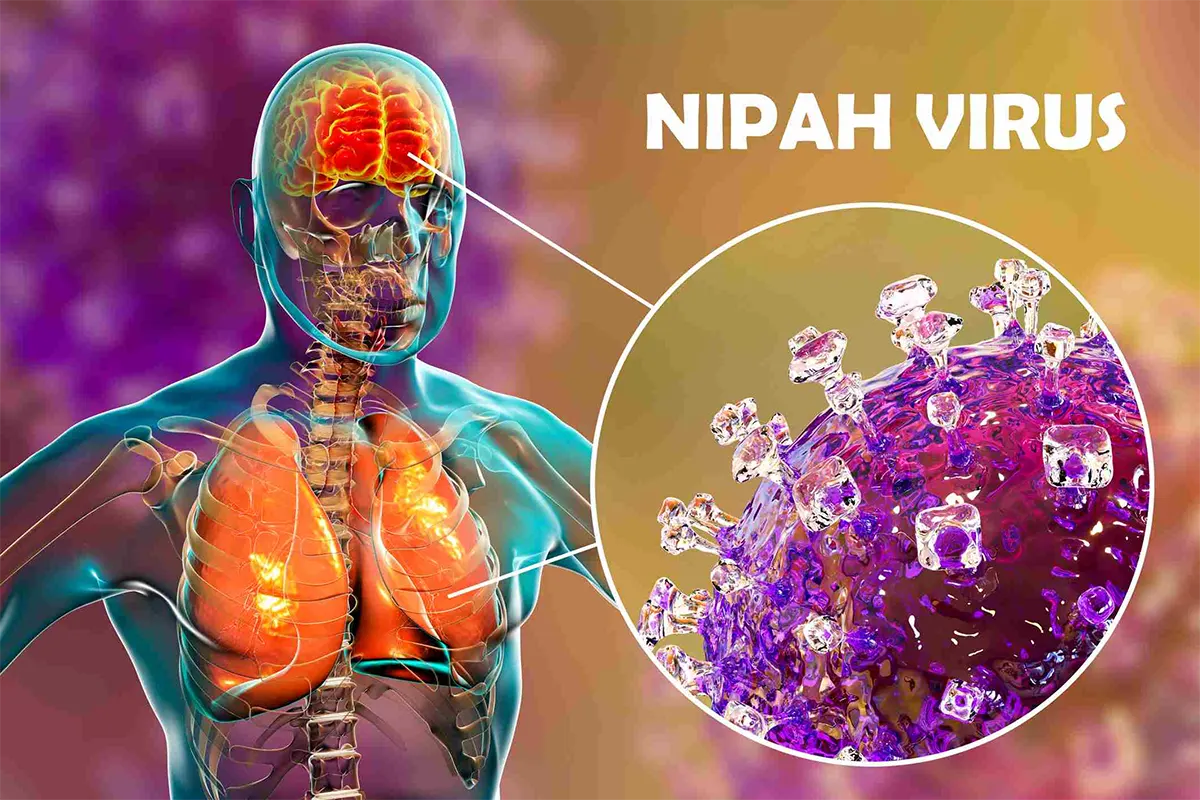 vírus Nipah
